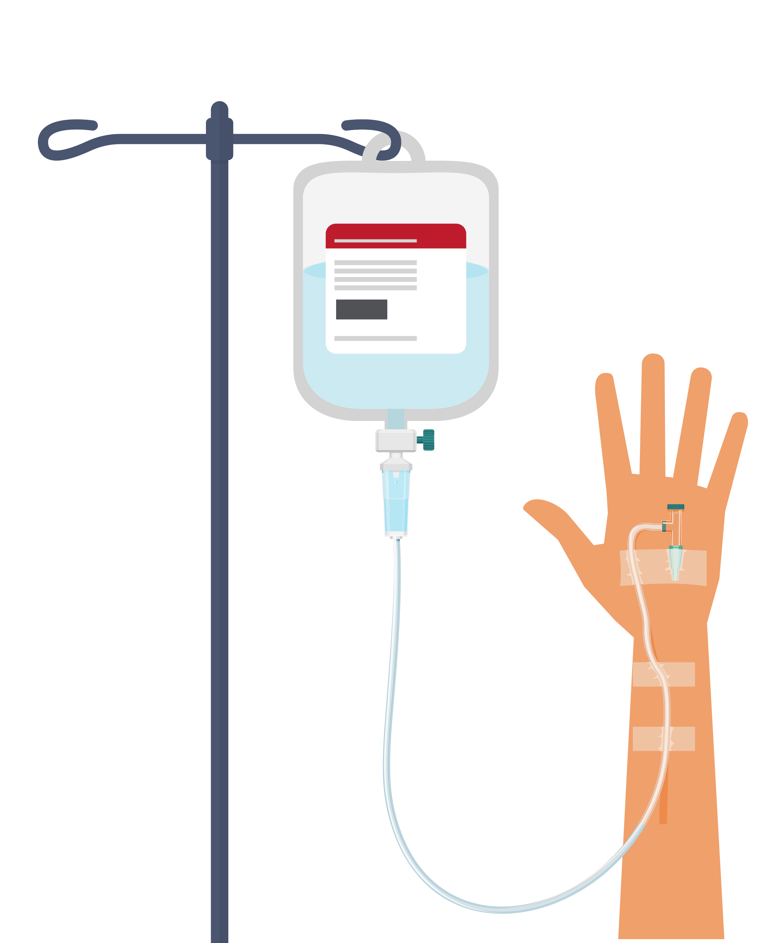 Perfusion intraveineuse